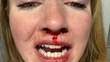 Woman 'terrified' to return to downtown area after 'homophobic' attack by group of men in Halifax, Canada