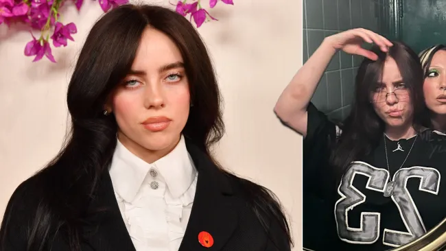 Billie Eilish sparks concern with photos of bizarre bite marks