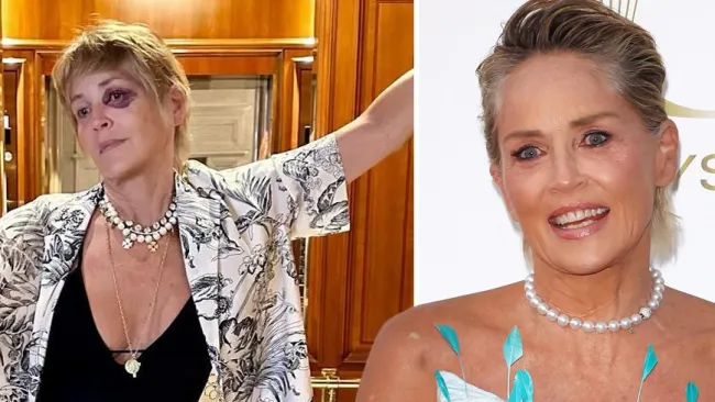 Sharon Stone sparks concern after revealing black eye on holiday amid ‘tough trip’