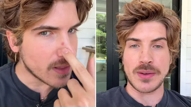 Classic Youtuber Joey Graceffa, 33, reveals skin cancer diagnosis