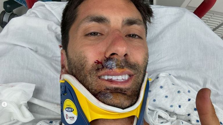 Catfish presenter Nev Schulman breaks neck in bike crash