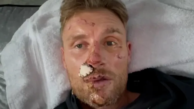 Freddie Flintoff’s show branded ‘hard to watch’ over previously unseen footage taken after crash