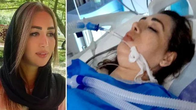 Mum paralysed after police ‘shot her in the back’ for violating Iran’s hijab law