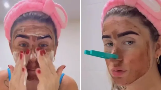 Doctors warn against ‘revolting’ TikTok faecal facial