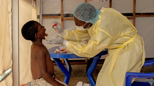 Mpox declared a global emergency by WHO