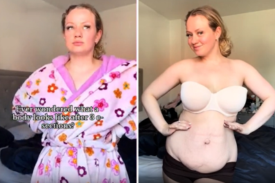 Mom Hopes To Normalize Postpartum Bodies by Showing Hers After 3 C-Sections