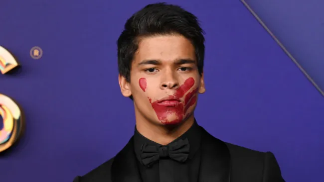 Actor silently makes ‘huge statement’ with bloody handprint on Emmys 2024 red carpet