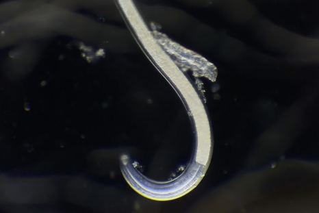 Amazing Video of 'Water Bear' Riding Worm Among Microscopic Contest Winners