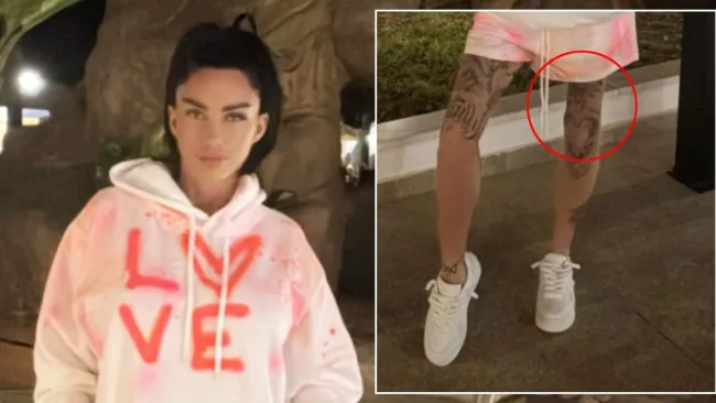 Katie Price in ‘Photoshop fail’ as fans question: ‘What’s happened to your leg?’